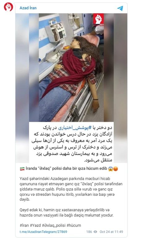 İranda əxlaq polisi daha bir qıza hücum edib - FOTO