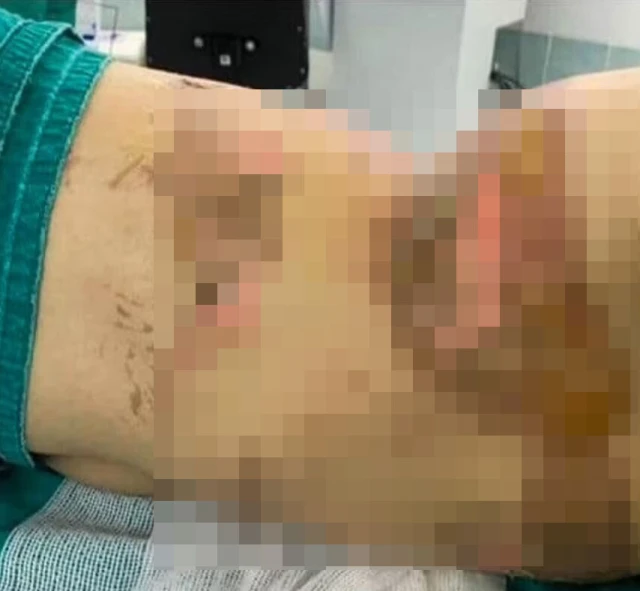 Məşhur model türkəçarə zamanı od tutub yandı - FOTO/VİDEO