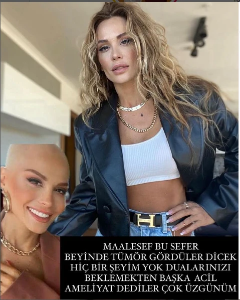 Tanınmış müğənninin beynində şiş aşkarlandı - FOTO