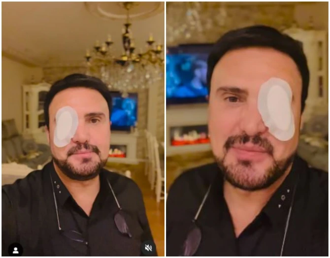 Nadir Qafarzadə bir gözündən əməliyyat olundu - FOTO