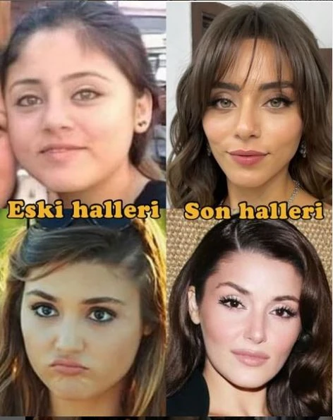 Məşhurların arxiv görüntüləri “Estetik etdirməmişəm” iddialarını yalanladı - FOTO
