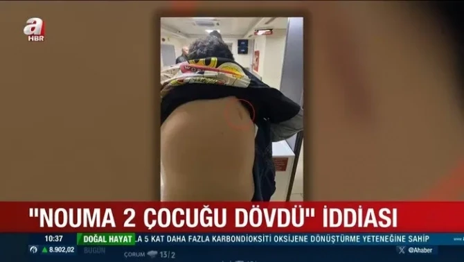 Paskal Nouma yeni qalmaqala düşüb - FOTO