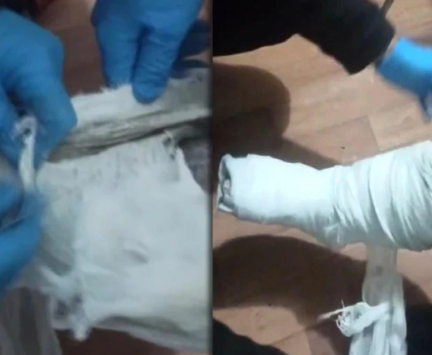 Sərnişinin ayağındakı gipsdən 293 qram heroin çıxdı - FOTO/VİDEO