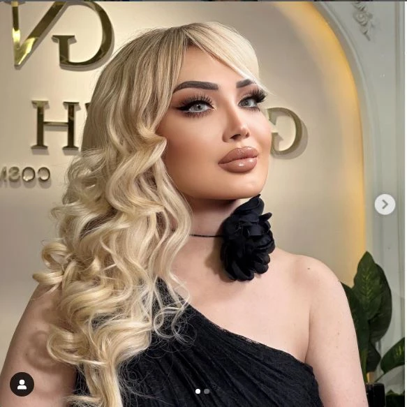 58 yaşlı Məleykə Əsədova: 