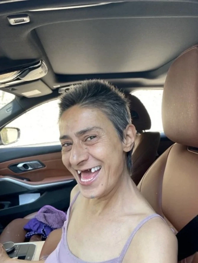 Yıldız Tilbe bu görüntüsü ilə hamını şoka saldı - FOTO