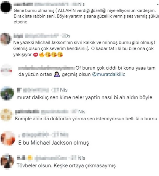 Murat Dalkılıç 9-cu dəfə əməliyyat olundu: Maykl Cekson bənzədildi