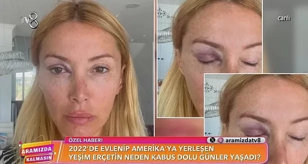 Müğəninin iş adamı həyat yoldaşı vanna otağında ölü tapıldı - FOTO