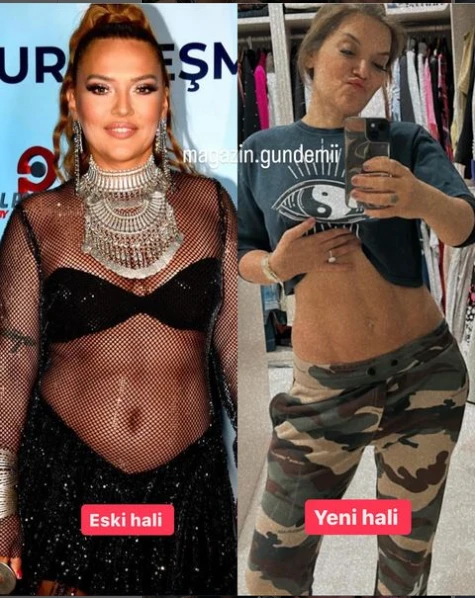 Demet Akalın 11 kiloqram arıqlayıb belə oldu - FOTO