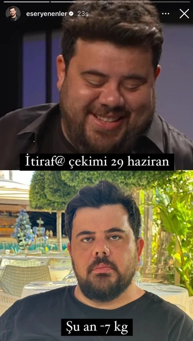Eser Yenenler 7 gündə 15 kiloqram arıqladı - FOTO