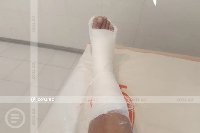 TƏBİB Sabunçu Tibb Mərkəzində pasiyentin öz hesabına gips alması iddialarına aydınlıq gətirdi