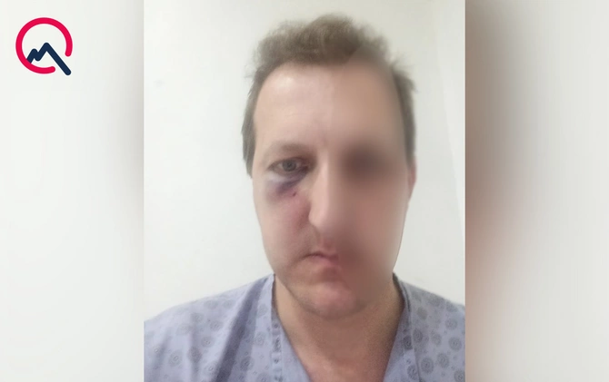 Bakıda Xalq artistinin oğlunu döydülər - Saxlanılan var