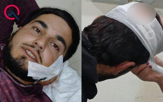 Ağdamda iki qardaş 12 manata görə bıçaqlandı