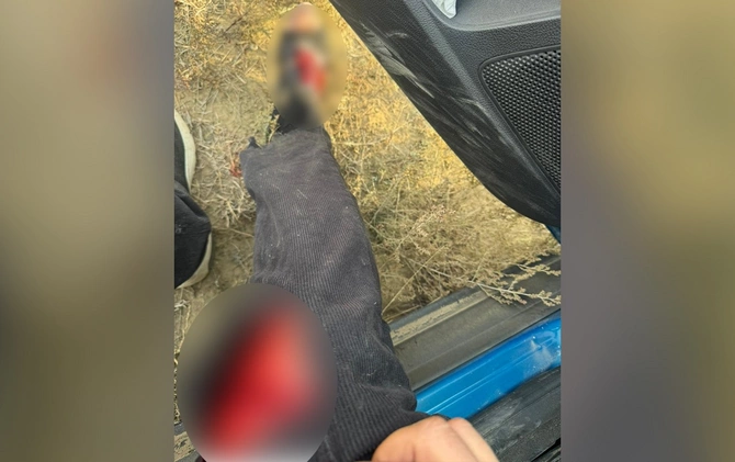 AzTV-nin müxbiri təyyarənin qəzaya düşdüyü ərazidə xəsarət aldı