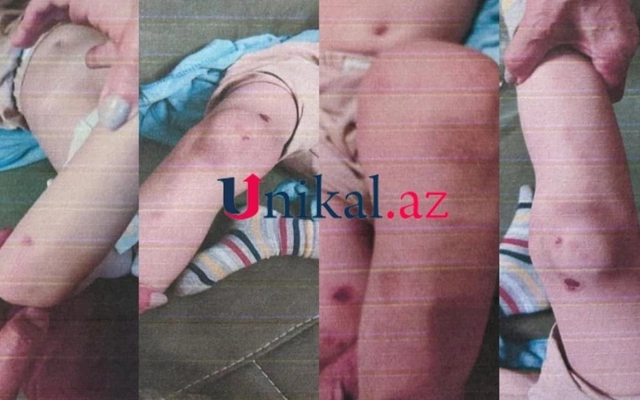 Bakıda ana sevgilisi ilə birlikdə azyaşlı oğluna işgəncə verdi