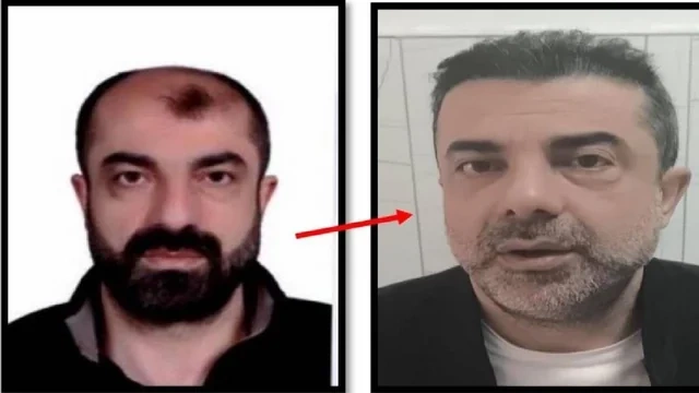 Əməliyyatla üzünü dəyişdirən şəxs illər sonra Türkiyədə həbs edildi