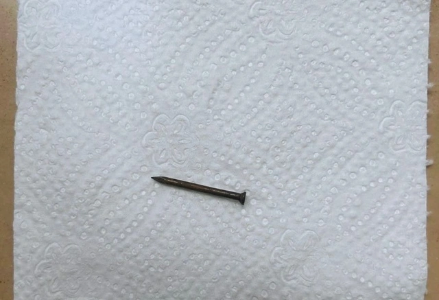 В Баку из желудка подростка извлекли гвоздь