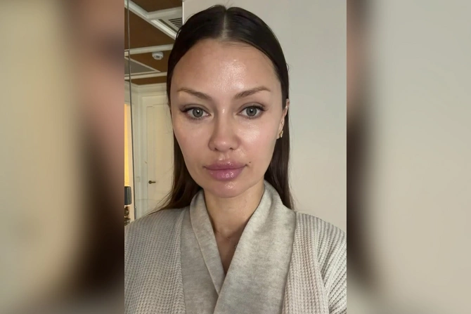 Victoria Bonya showed what her face looks like without filters