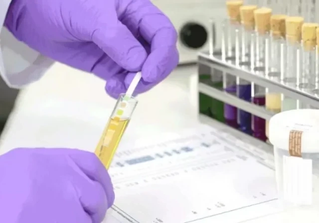 Nikahdan əvvəl narkotest tələbi və reallıqlar: Mütəxəssislər nə düşünürlər?