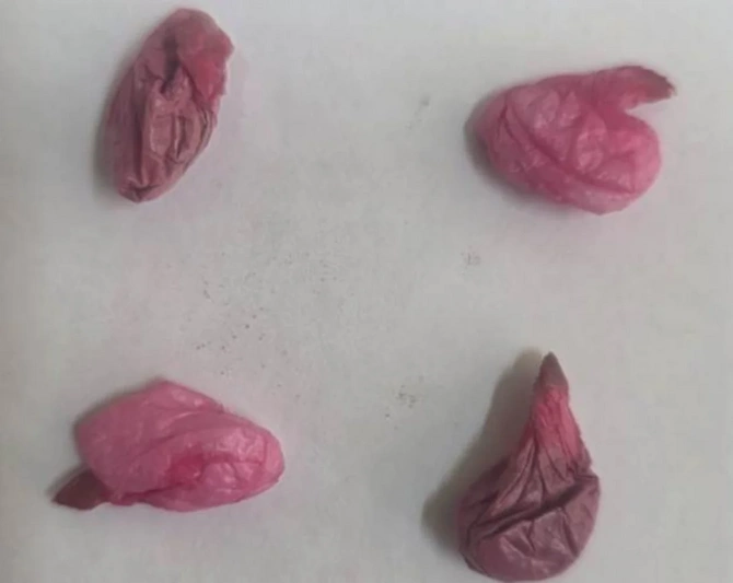 Həbsxanaya göndərilən bağlamadan narkotik çıxdı – Marixuana, heroin və metamfetamin aşkarlanıb