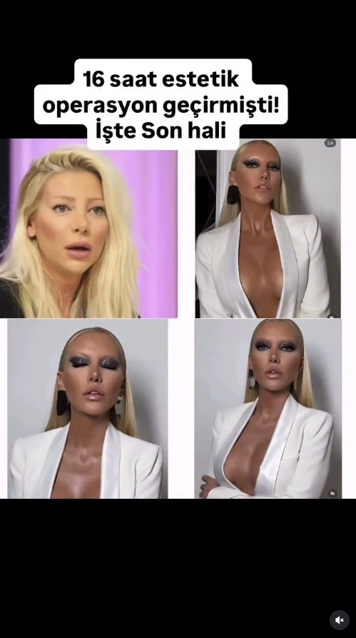 16 saatlıq əməliyyatdan çıxan modelyeri görənlər tanımadı