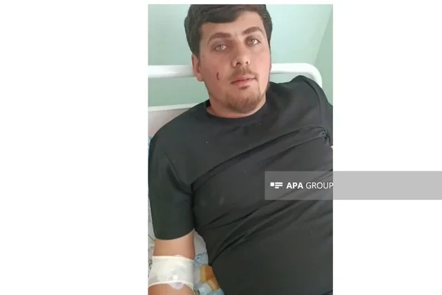 Dron hücumunda yaralanan Azərbaycan vətəndaşı DANIŞDI