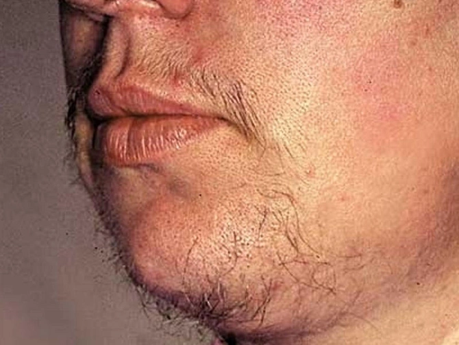 Üzünüzdə bu dəyişiklər varsa, DİQQƏTLİ OLUN!