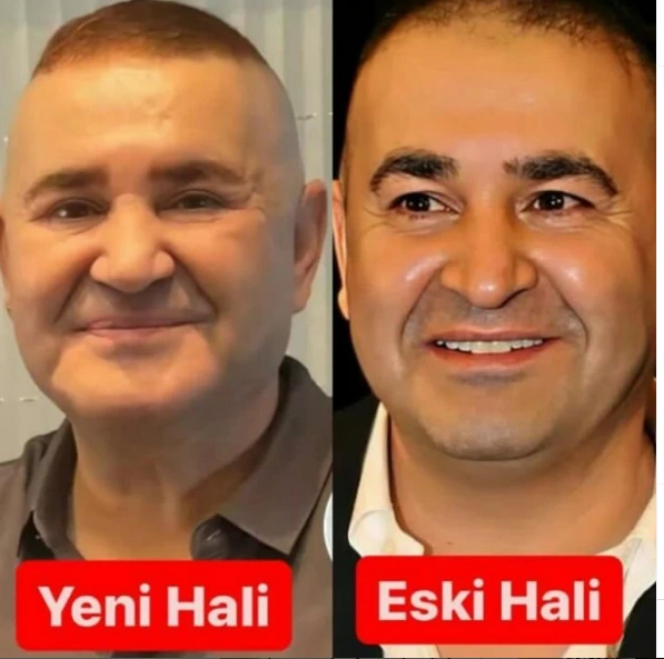 54 yaşlı aktyor tanınmaz hala düşdü