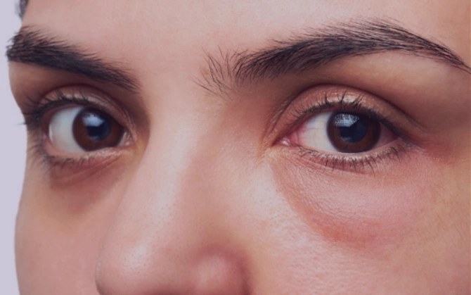 Üzünüzdə bu dəyişiklər varsa, DİQQƏTLİ OLUN!