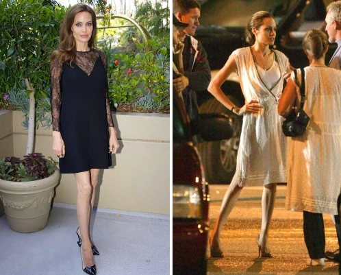 Anoreksiyadan əziyyət çəkən DÜNYA ULDUZLARI - SİYAHI