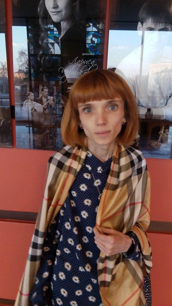 17 Kiloqram çəkisi olan fenomen qadın: 