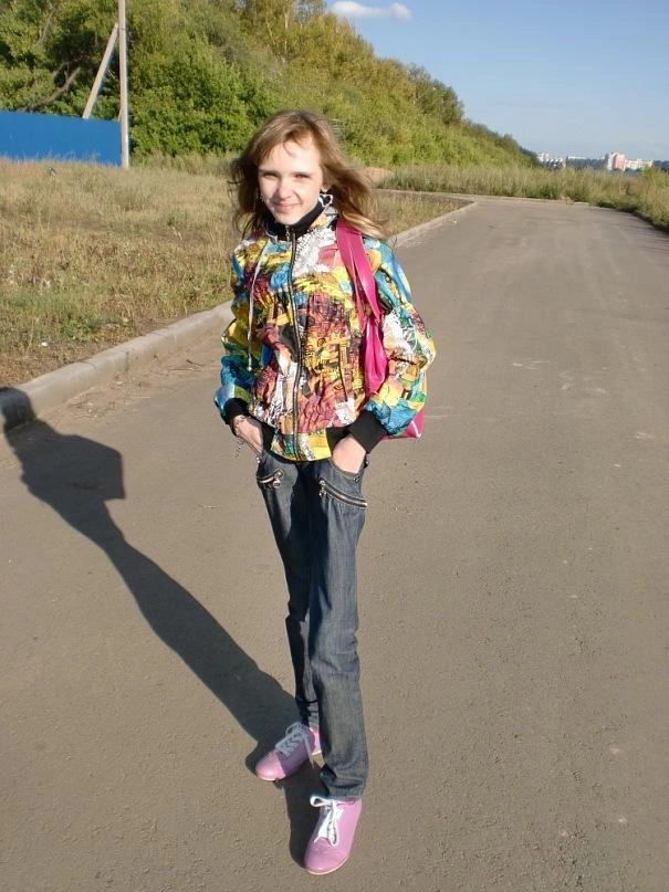 17 Kiloqram çəkisi olan fenomen qadın: 