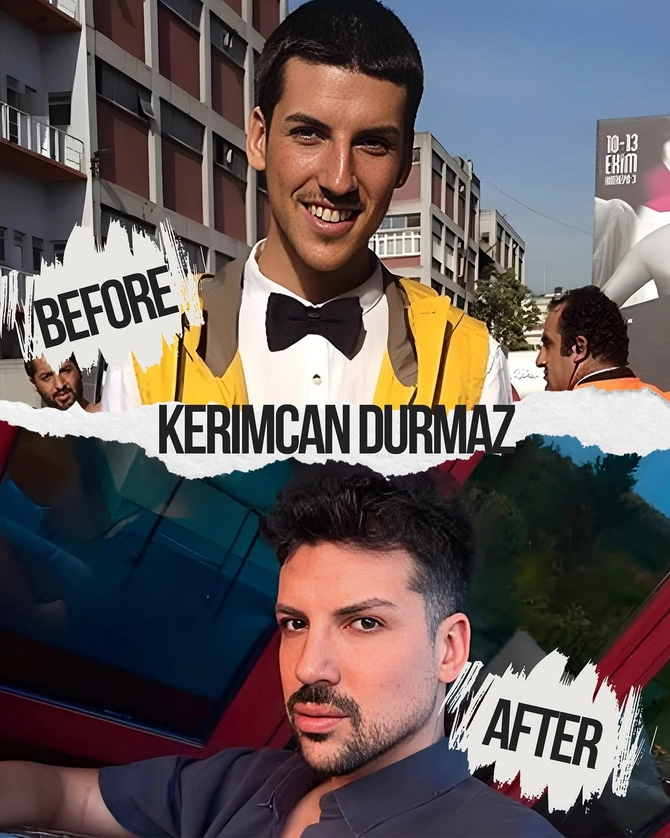 Türkiyəli məşhurların illər ərzindəki dəyişimi