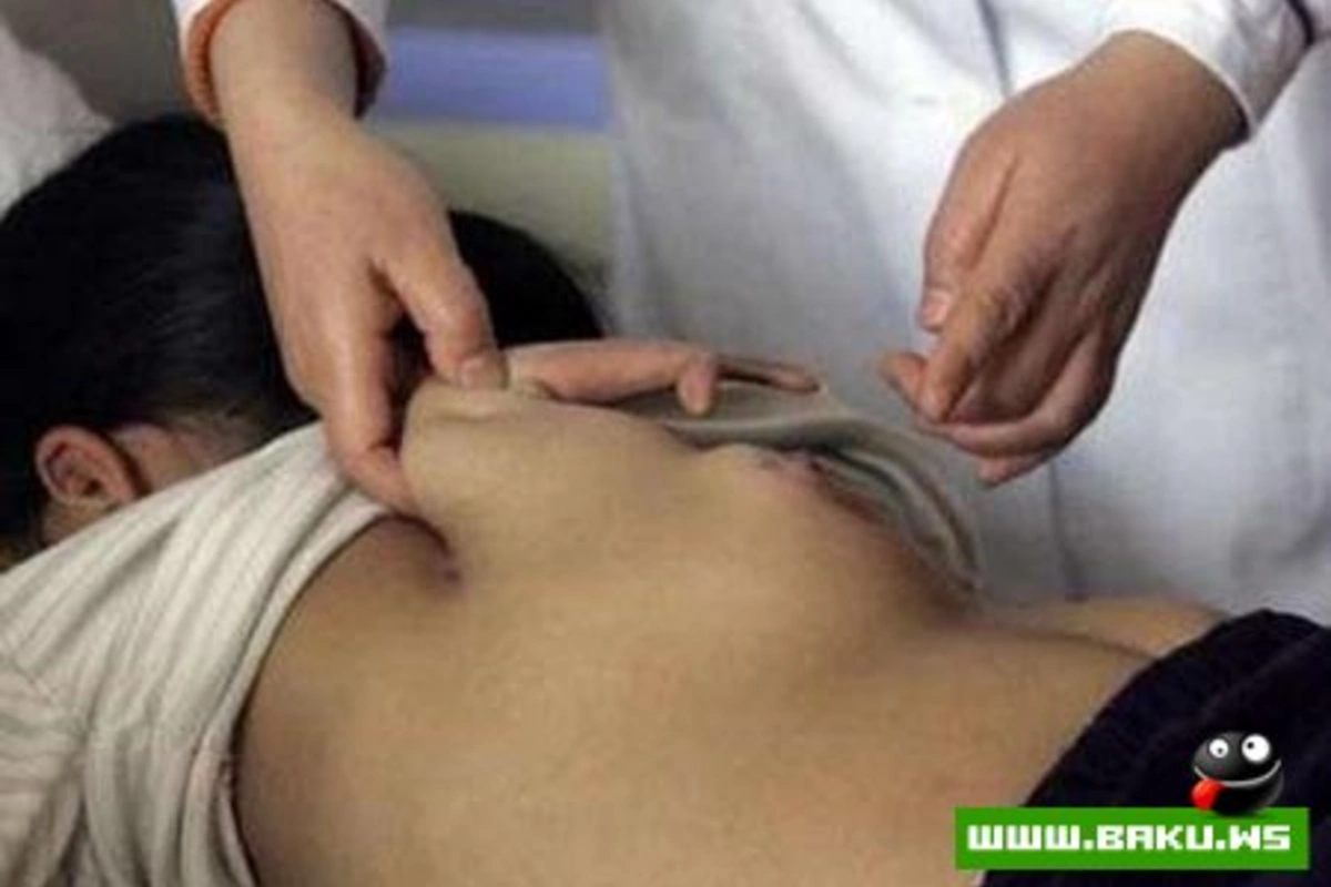 В Китае девочке отрезали ангельское крыло?