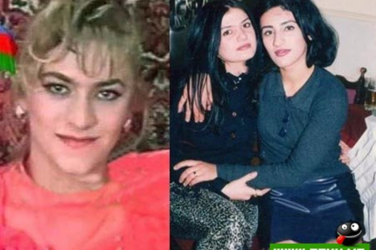 Şou-biznesimizin plastik əməliyyat keçirən simaları - 30 FOTO