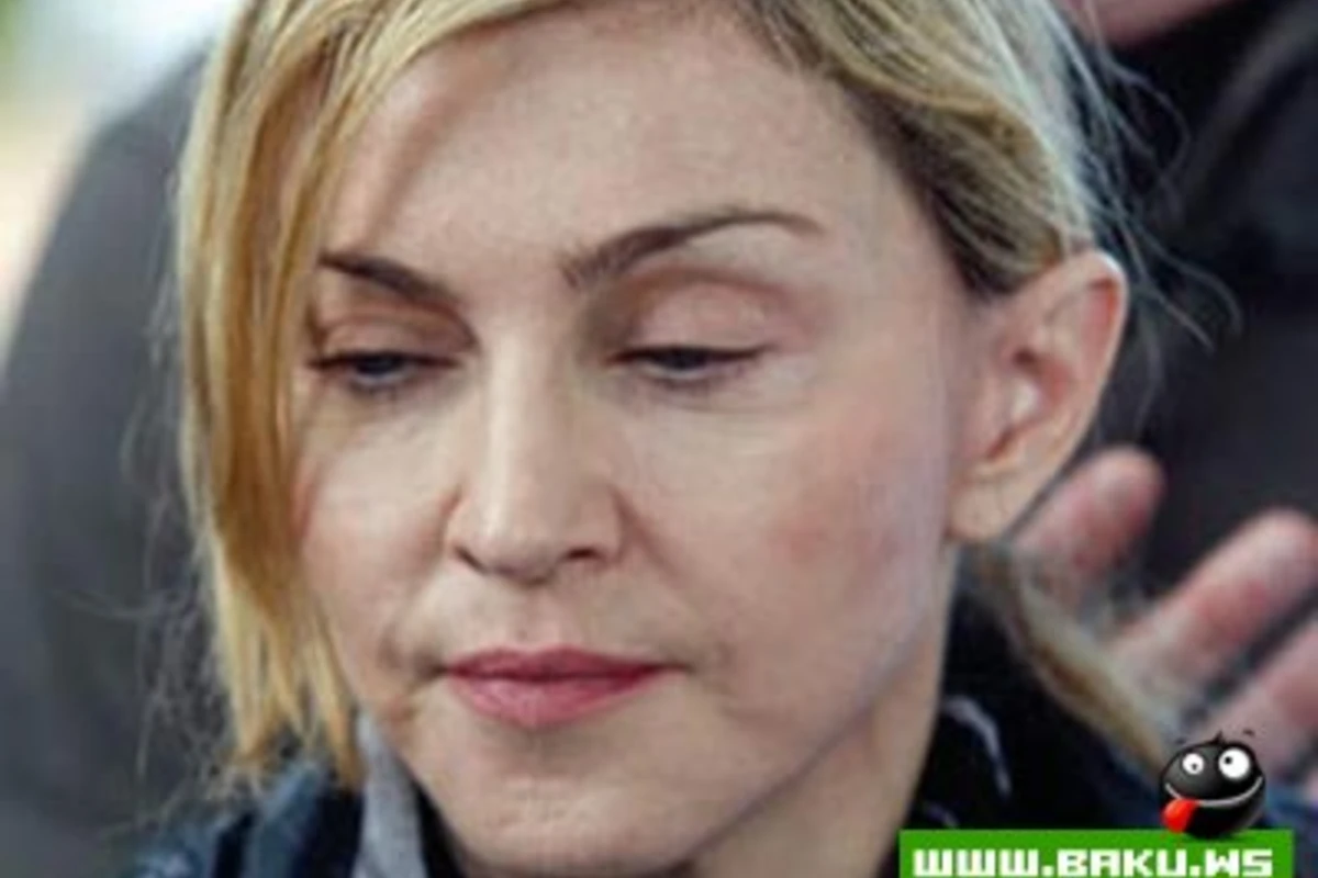 Madonnadan 200 min dollarlıq plastik əməliyyat
