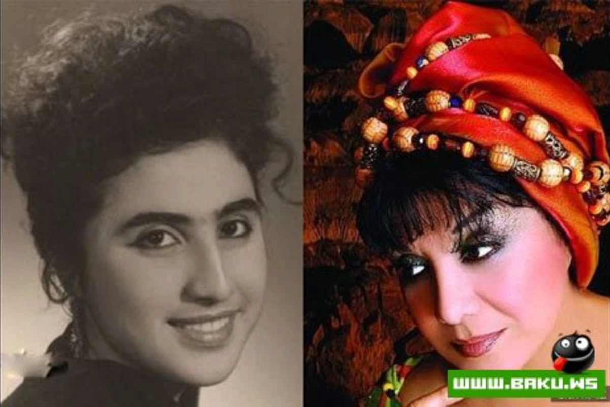Azərbaycan ulduzları plastik əməliyyatlardan əvvəl və sonra