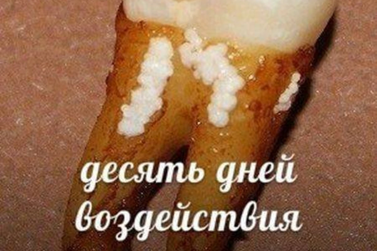 Напитки, которые разрушают наши зубы