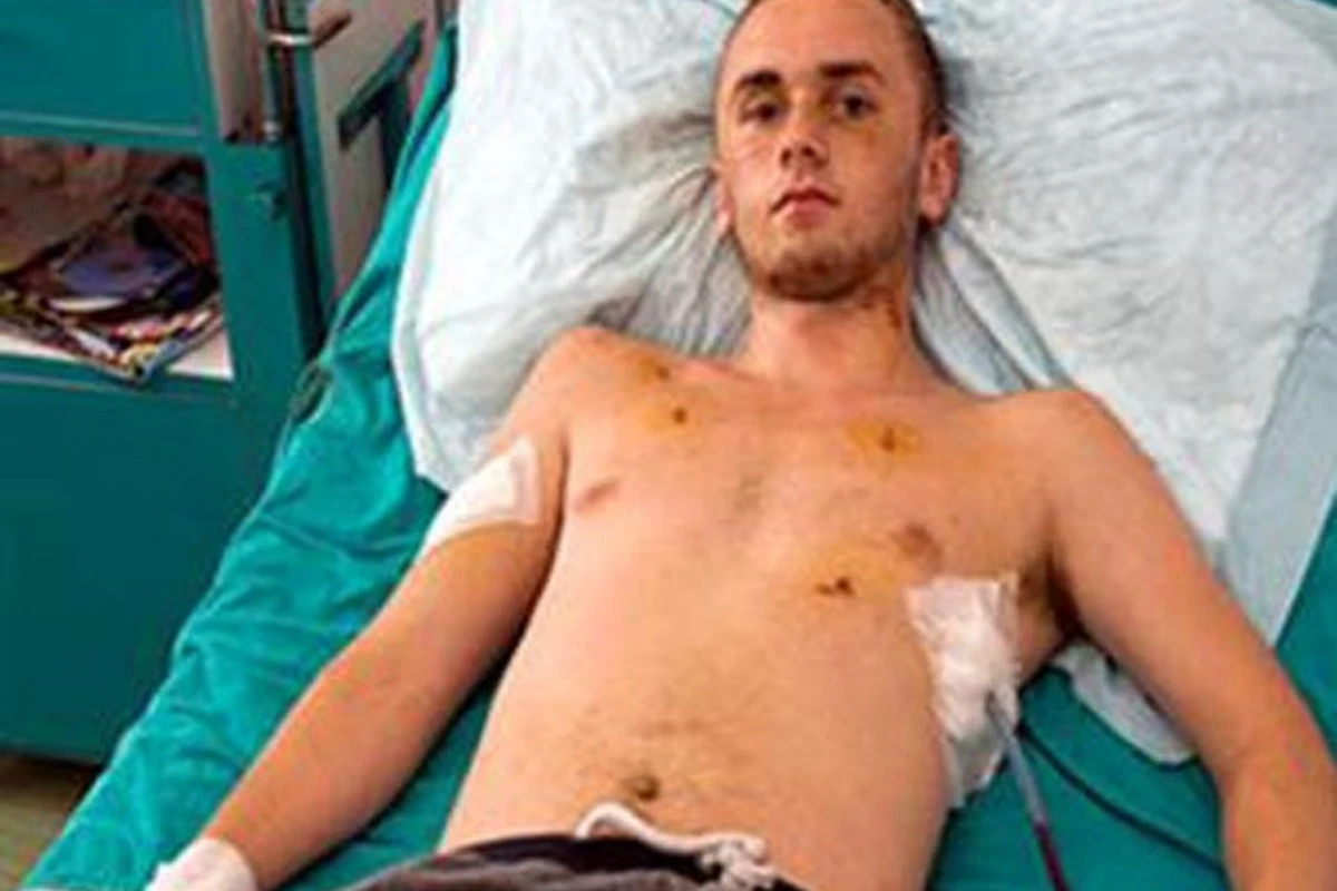 В Турции 17-летнему британцу изрезали промежность за поцелуй в баре