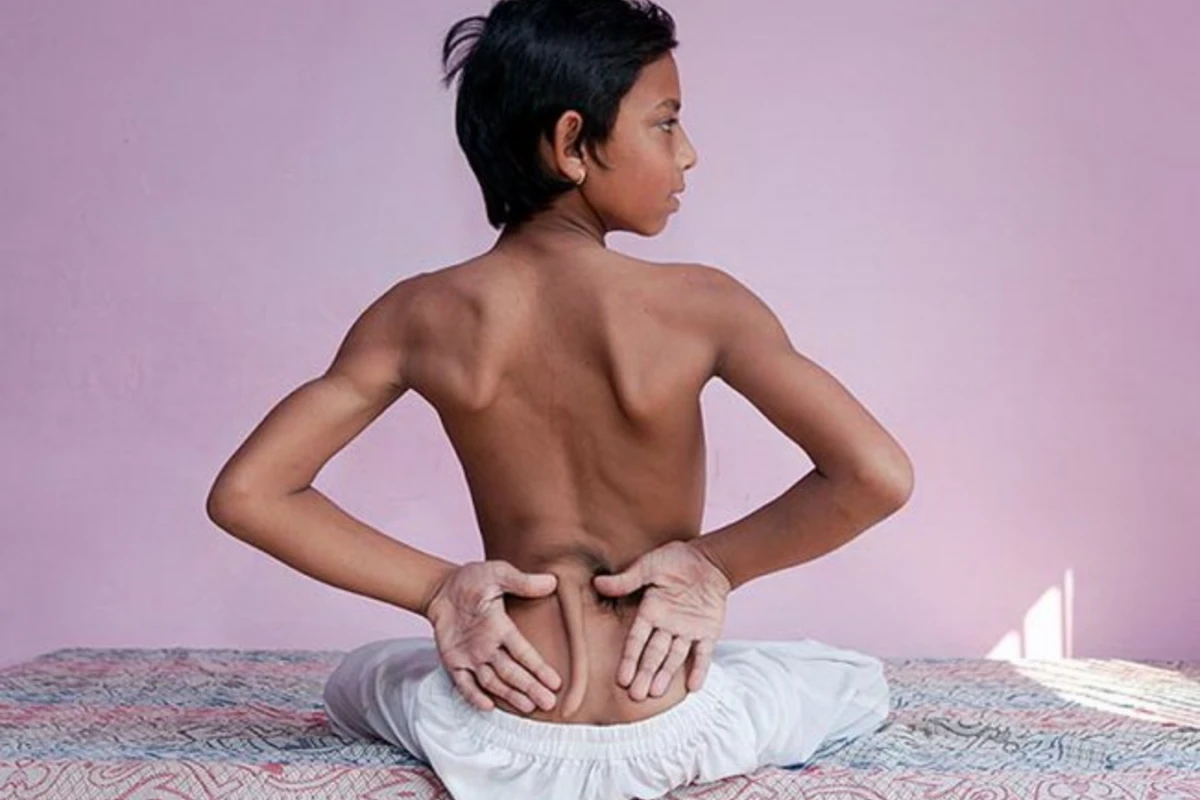 В Индии люди поклоняются мальчику с хвостом