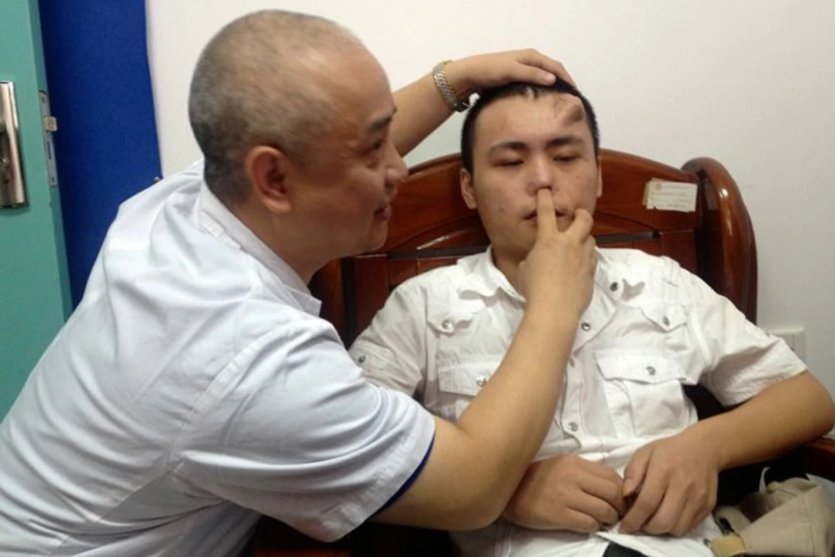 Китайские медики «вырастили» на лбу пациента нос