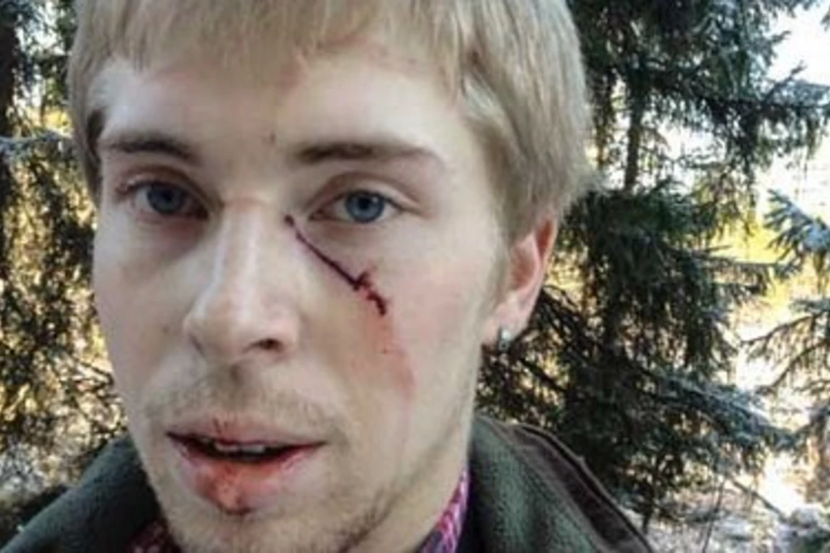 На вратаря шведской команды напал медведь