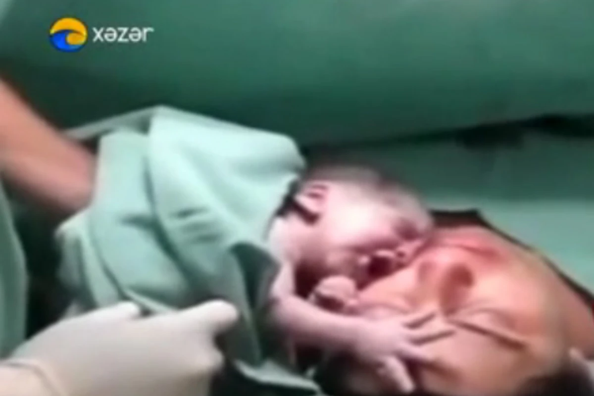Новорожденный малыш удивил весь мир (видео) Новорожденный малыш удивил весь мир (видео)