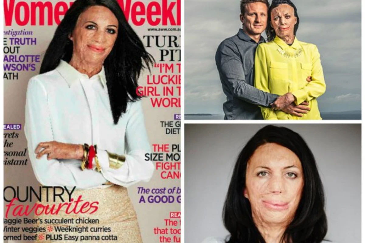 Женщина, выжившая после лесного пожара, на обложке журнала Australian Women’s Weekly