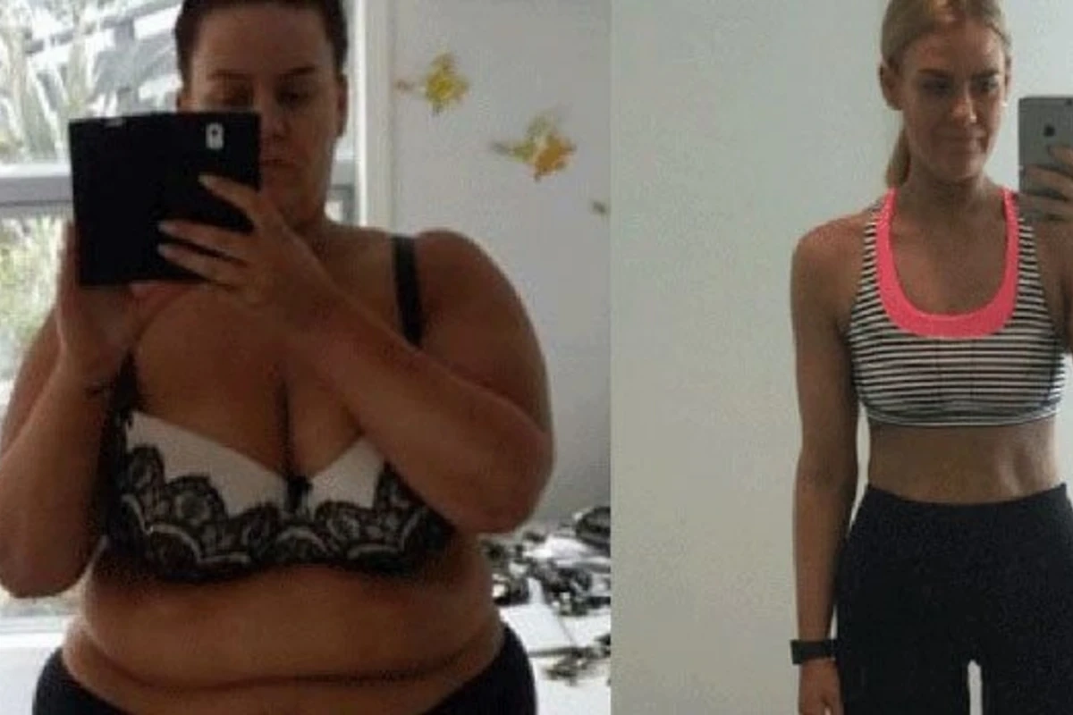 88 kilo arıqlayan qadın (FOTO) 88 kilo arıqlayan qadın (FOTO)