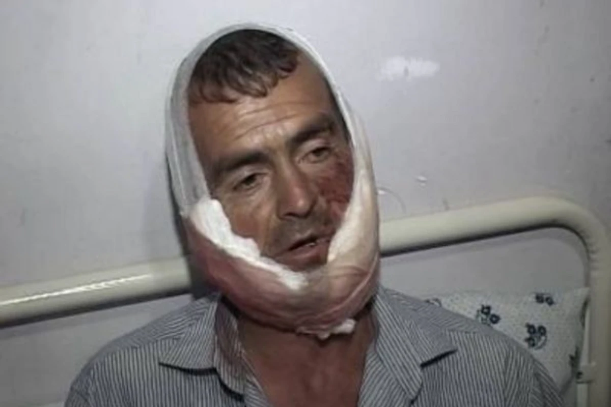 На жителя Азербайджана напала стая волков (видео)