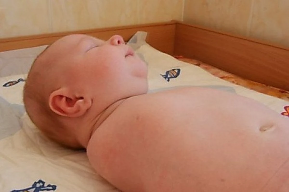 В Азербайджане родился ребенок с одной рукой