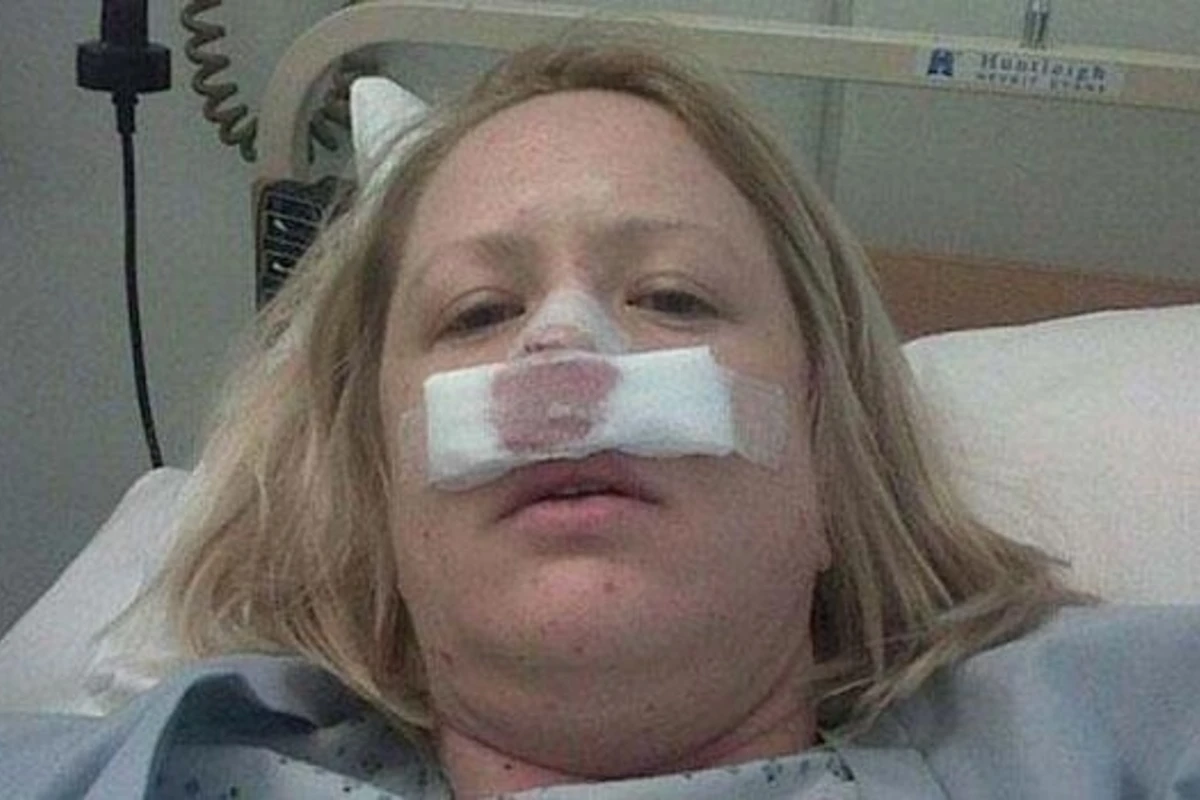 Möhkəm asqıran qadının burnu düşdü (FOTO) Möhkəm asqıran qadının burnu düşdü (FOTO)