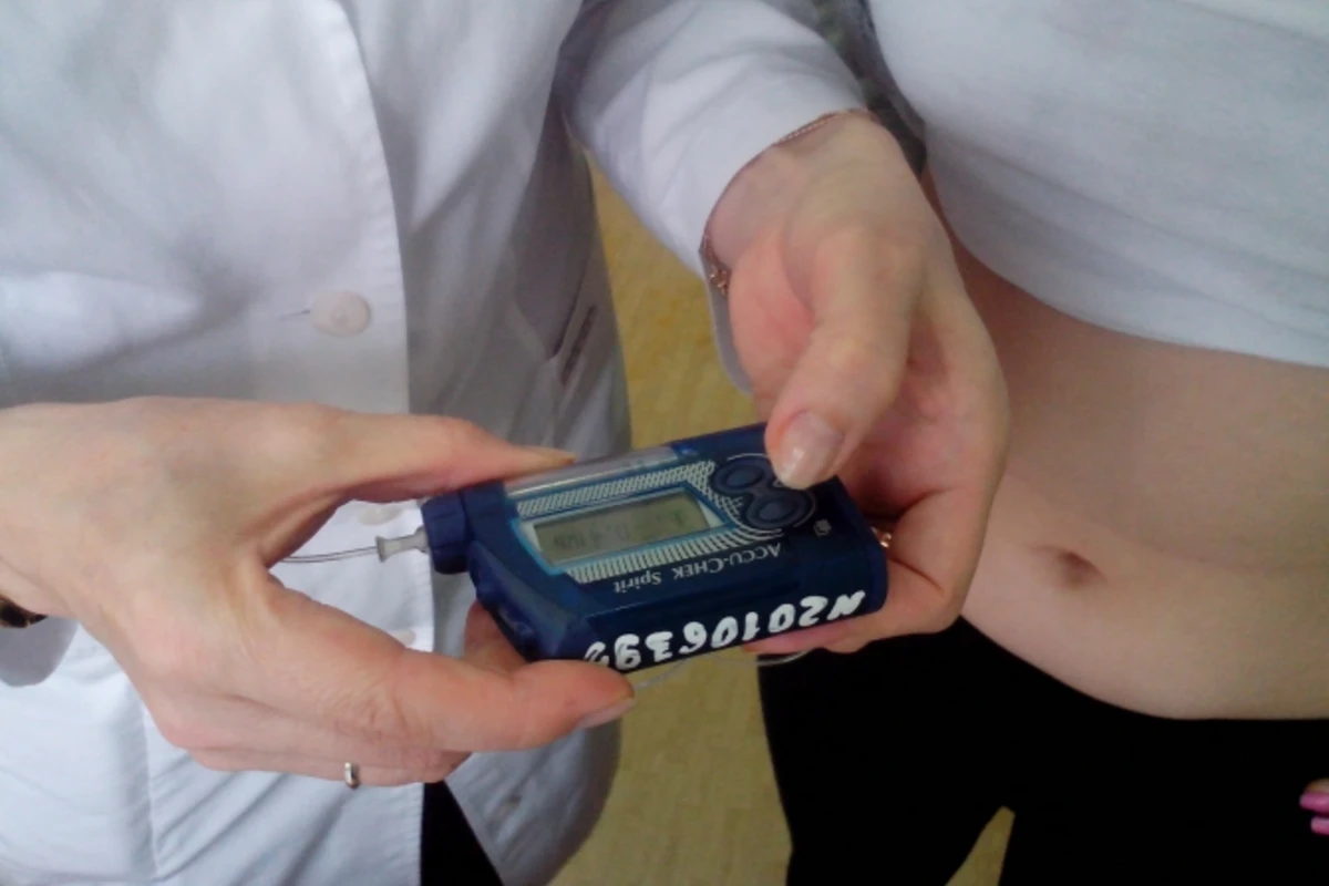 В 2016 году Азербайджан обеспечит больных детей 200 инсулиновыми помпами