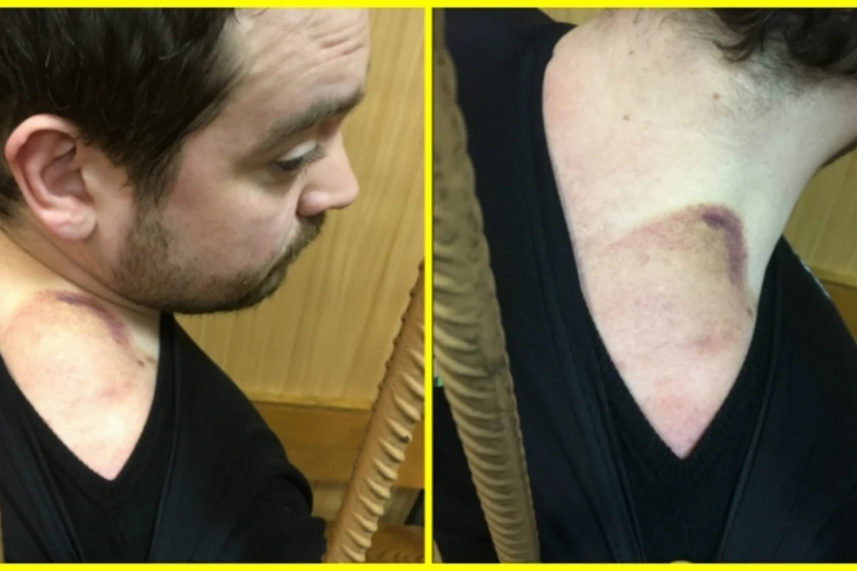 Новые подробности ареста Давидыча и фотографии побоев, полученных за решеткой (видео)