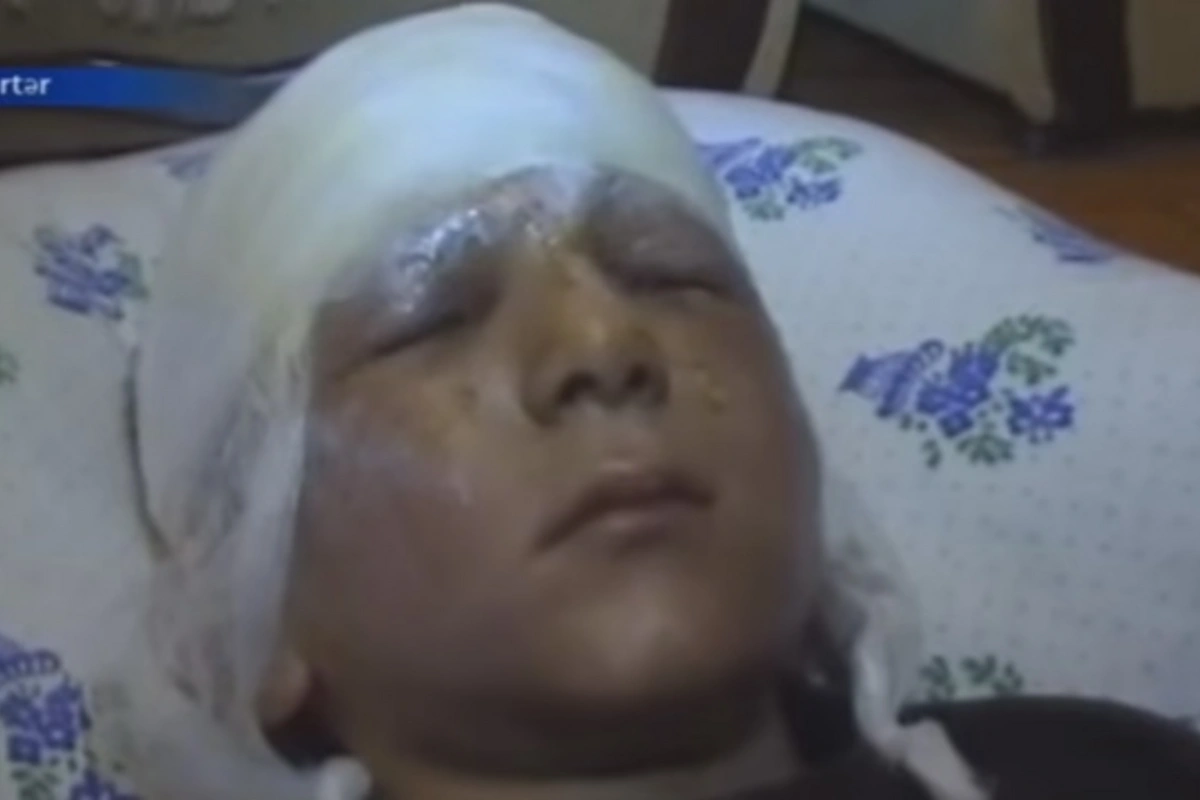 В Тертере взорвался снаряд: обгорел 8-летний ребенок (видео)